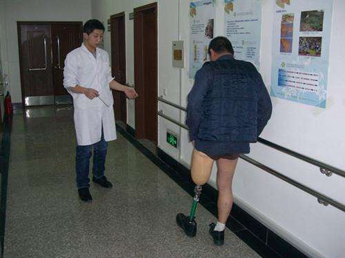 河南假肢對(duì)殘肢安裝假肢的要求有哪些(圖1) 河南假肢對(duì)殘肢安裝假肢的要求有哪些(圖1)