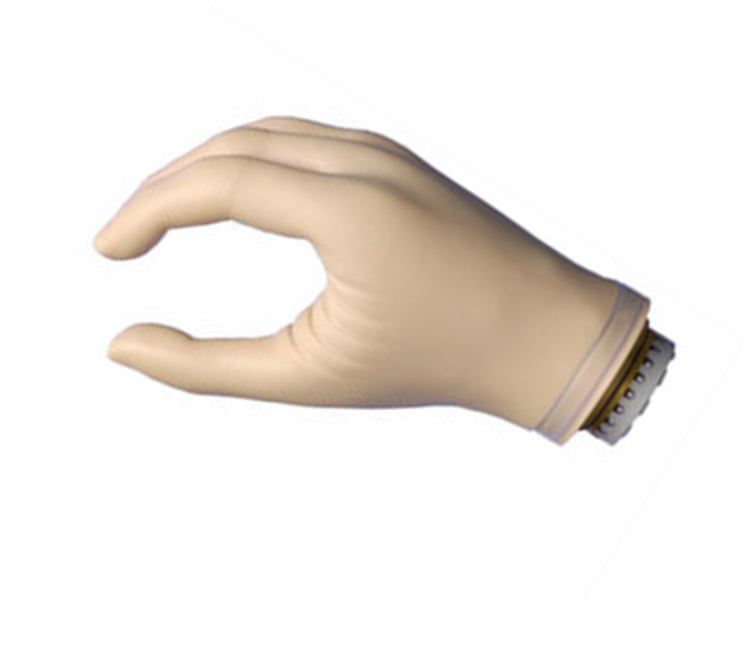 截肢者假肢可能出現(xiàn)的術后癥狀