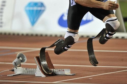 安裝假肢之后是否可以運(yùn)動(dòng)健身?(圖1) 假肢